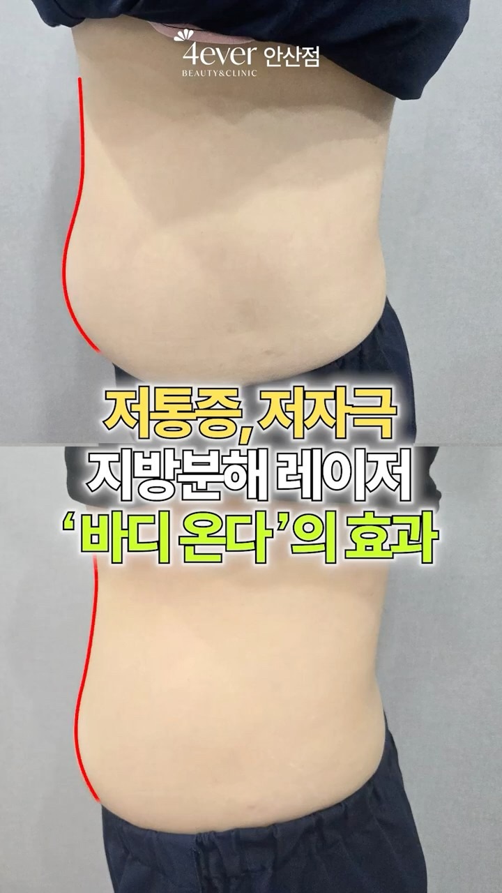 유튜브쇼츠